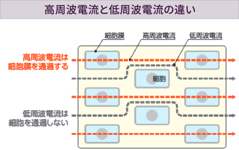高周波電流と低周波電流の違い