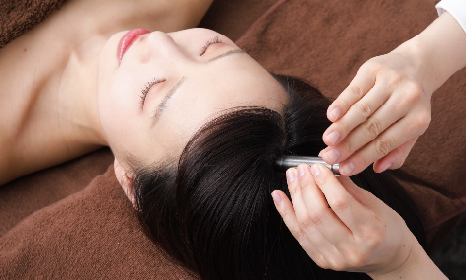 4. 頭皮に育毛鍼