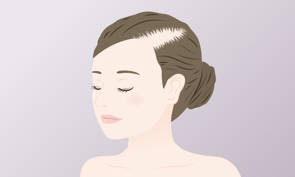 1. 全体的に毛量が減ってきた