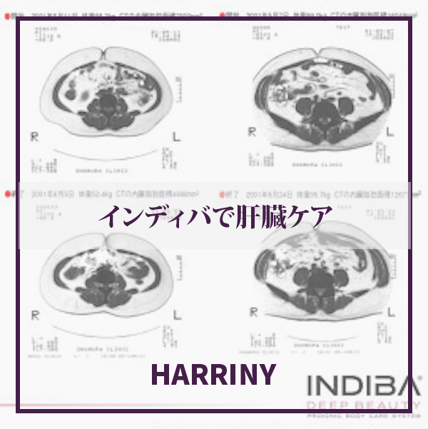 インディバで肝臓ケア